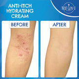 Anti-Itch Soothing Relief Cream 250 ml