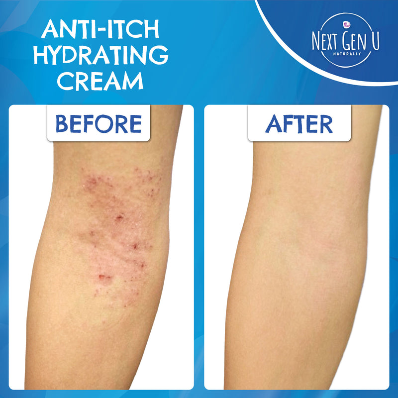 Anti-Itch Soothing Relief Cream 250 ml