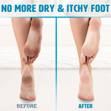 Moisturising & Cooling Foot Cream for Athletes Foot (250 ml)