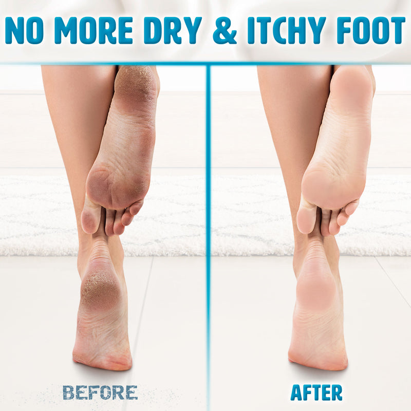 Moisturising & Cooling Foot Cream for Athletes Foot (250 ml)