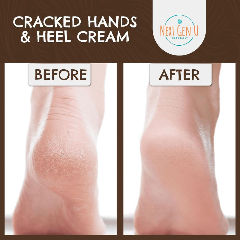 Hand & Heel Cream for Dry Hands & Feet 250 ml